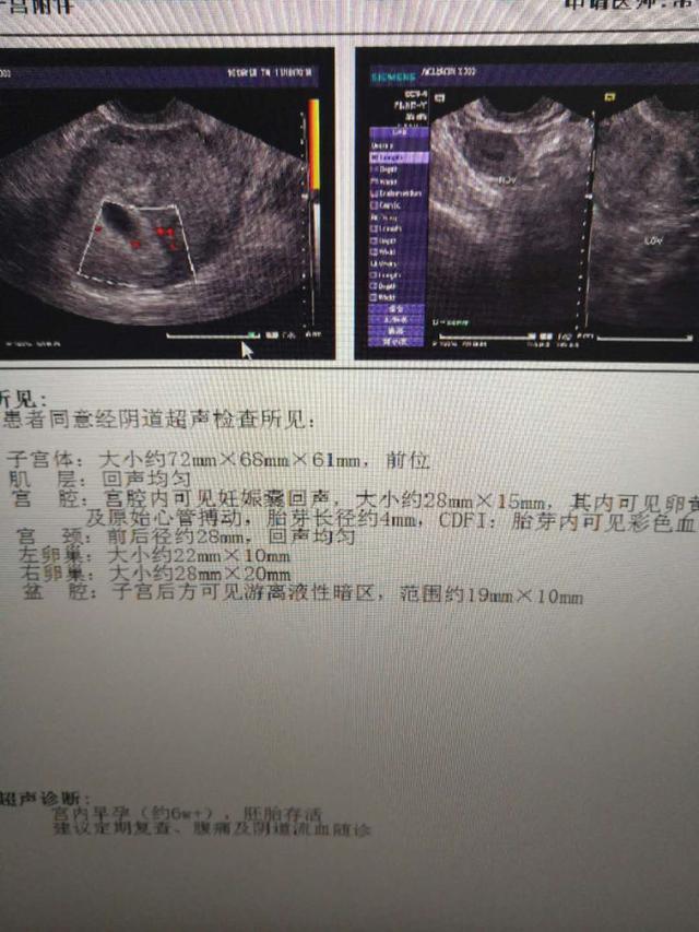 孕期计算，怀孕27周2天究竟相当于几个月？