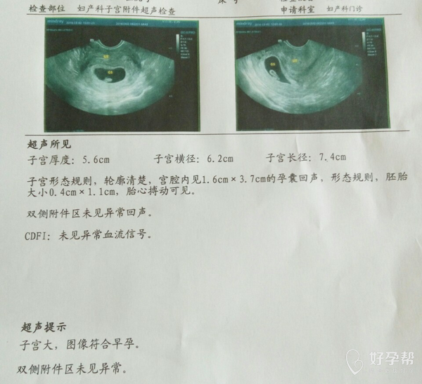 四个月胎儿胎心位置图及其重要性